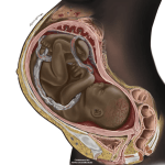 Black fetus